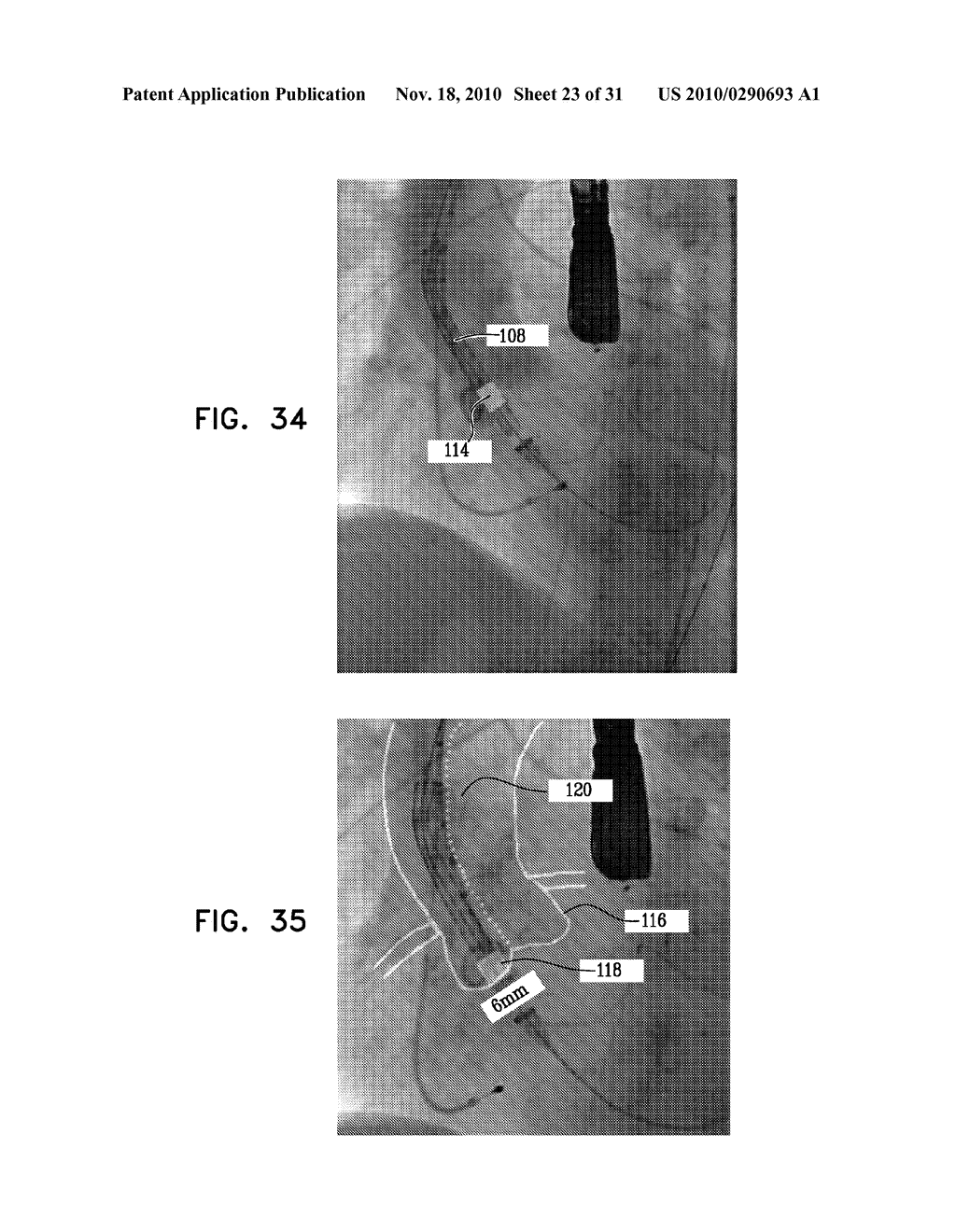 LOCATION-SENSITIVE CURSOR CONTROL AND ITS USE FOR VESSEL ANALYSIS - diagram, schematic, and image 24