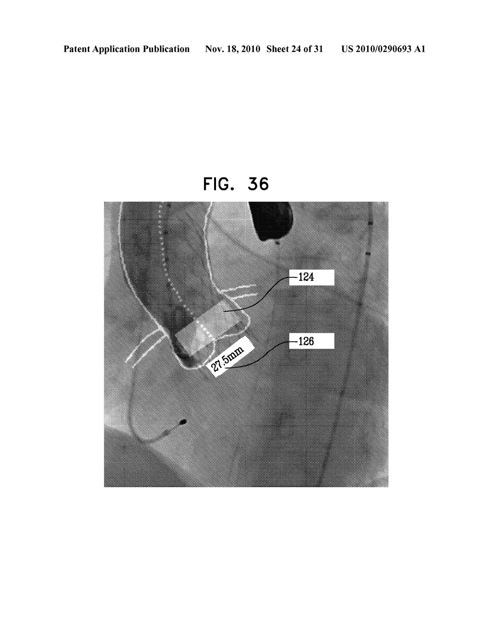 LOCATION-SENSITIVE CURSOR CONTROL AND ITS USE FOR VESSEL ANALYSIS - diagram, schematic, and image 25