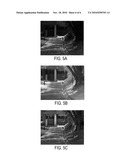 Enhancing Photograph Visual Quality Using Texture and Contrast Data From Near Infra-red Images diagram and image