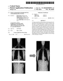 IMAGE ACQUISITION METHOD, DEVICE AND RADIOGRAPHY SYSTEM diagram and image