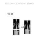 IMAGE ACQUISITION METHOD, DEVICE AND RADIOGRAPHY SYSTEM diagram and image