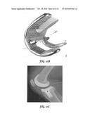 RETICULATED MESH ARRAYS AND DISSIMILAR ARRAY MONOLITHS BY ADDITIVE LAYERED MANUFACTURING USING ELECTRON AND LASER BEAM MELTING diagram and image