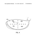 MULTI-COMPONENT GOLF CLUB HEAD diagram and image