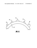 Planetary ring gear lug design for NVH improvement diagram and image