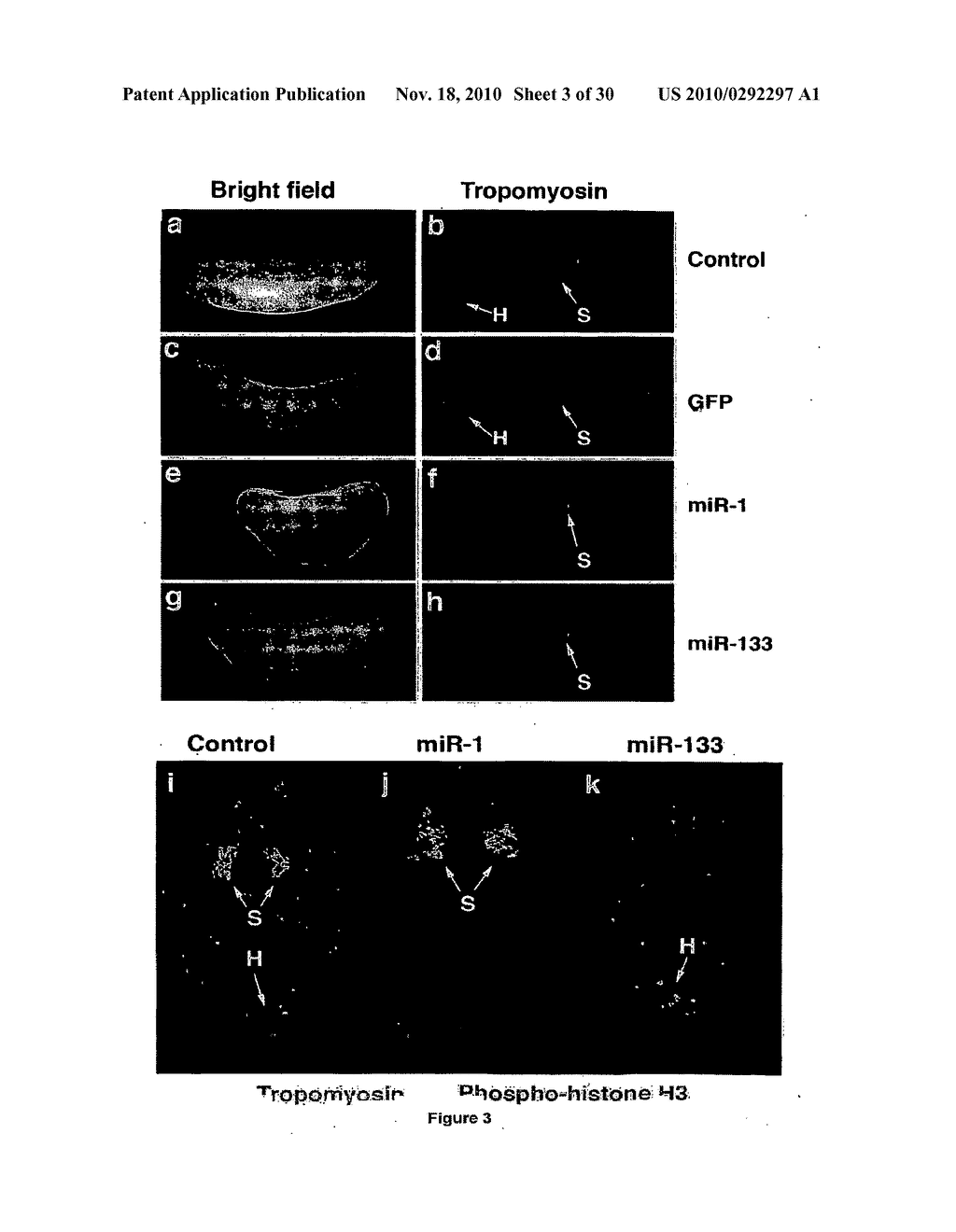 Micrornas That Regulate Muscle Cell Proliferation and Differentiation - diagram, schematic, and image 04