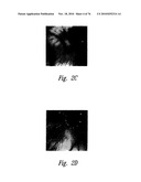 ANTI-ANGIOGENIC COMPOSITIONS AND METHODS OF USE diagram and image