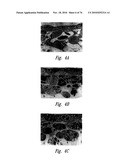 ANTI-ANGIOGENIC COMPOSITIONS AND METHODS OF USE diagram and image