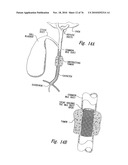 ANTI-ANGIOGENIC COMPOSITIONS AND METHODS OF USE diagram and image