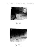 ANTI-ANGIOGENIC COMPOSITIONS AND METHODS OF USE diagram and image