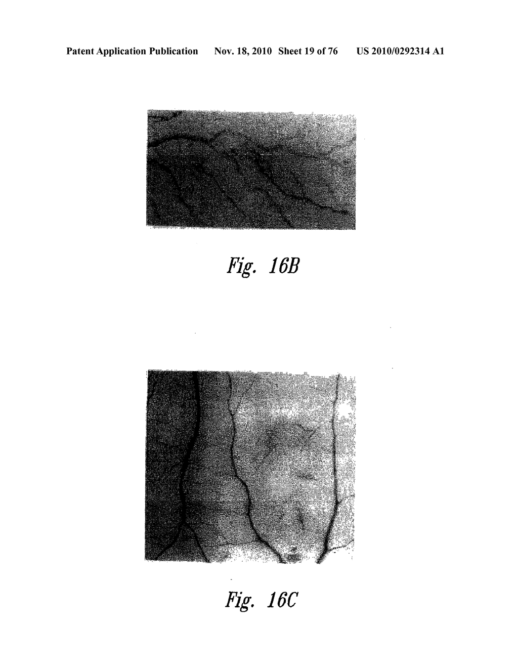 ANTI-ANGIOGENIC COMPOSITIONS AND METHODS OF USE - diagram, schematic, and image 20