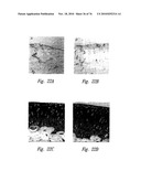 ANTI-ANGIOGENIC COMPOSITIONS AND METHODS OF USE diagram and image