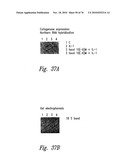 ANTI-ANGIOGENIC COMPOSITIONS AND METHODS OF USE diagram and image