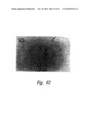 ANTI-ANGIOGENIC COMPOSITIONS AND METHODS OF USE diagram and image