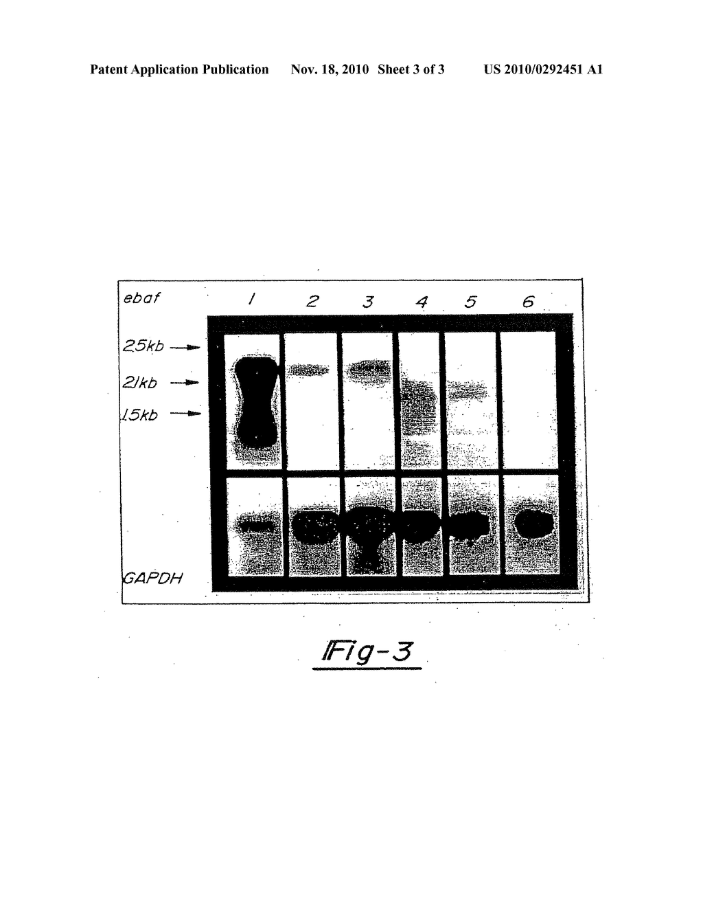 METHOD FOR DIAGNOSING SELECTED ADENOCARCINOMAS - diagram, schematic, and image 04