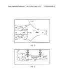  Wrap for a Heart Assist Device diagram and image