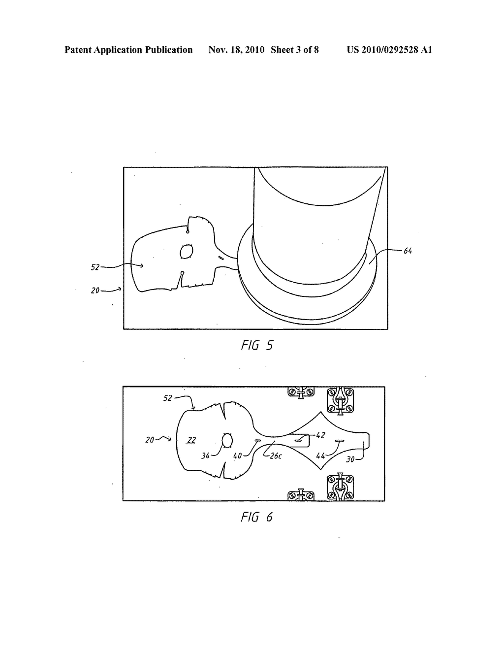  Wrap for a Heart Assist Device - diagram, schematic, and image 04