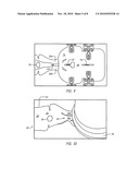  Wrap for a Heart Assist Device diagram and image