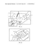  Wrap for a Heart Assist Device diagram and image