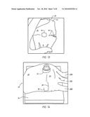  Wrap for a Heart Assist Device diagram and image