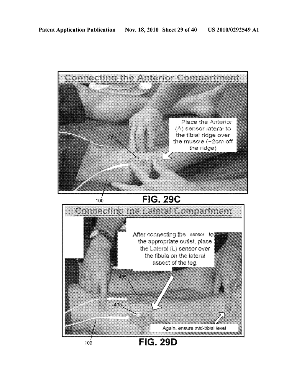 METHOD AND SYSTEM FOR MONITORING OXYGENATION LEVELS OF COMPARTMENTS AND TISSUE - diagram, schematic, and image 30