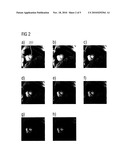 METHOD AND APPARATUS TO DETERMINE A MAGNETIC RESONANCE RELAXATION TIME IN THE HEART MUSCLE IN A MAGNETIC RESONANCE EXAMINATION diagram and image