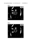 METHOD AND APPARATUS TO DETERMINE A MAGNETIC RESONANCE RELAXATION TIME IN THE HEART MUSCLE IN A MAGNETIC RESONANCE EXAMINATION diagram and image