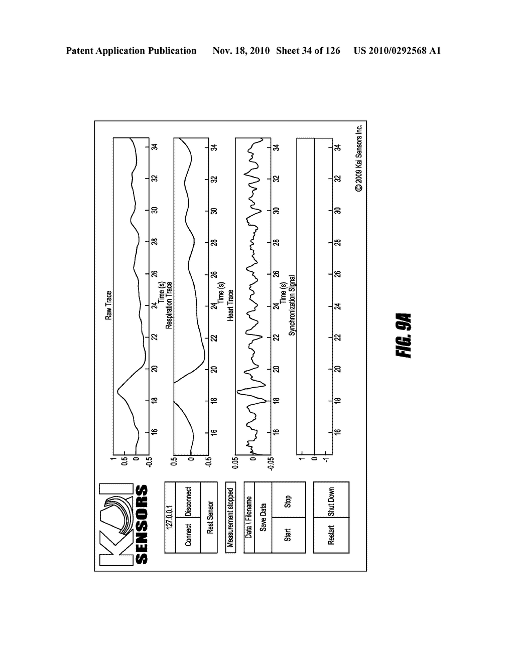 SYSTEMS AND METHODS FOR MEASUREMENT OF DEPTH OF BREATH AND PARADOXICAL BREATHING - diagram, schematic, and image 35