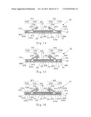 Disposable Absorbent Article diagram and image