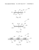 Disposable Absorbent Article diagram and image