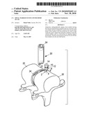 Spinal Marker System and Methods of Use diagram and image