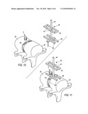 Spinal Marker System and Methods of Use diagram and image