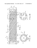 THREADED, FLEXIBLE IMPLANT AND METHOD FOR THREADING A CURVED HOLE diagram and image