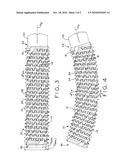 THREADED, FLEXIBLE IMPLANT AND METHOD FOR THREADING A CURVED HOLE diagram and image