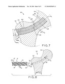 THREADED, FLEXIBLE IMPLANT AND METHOD FOR THREADING A CURVED HOLE diagram and image