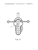 FEMORAL CONDYLE CUTTING AND SHAPING DEVICE diagram and image