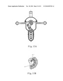 FEMORAL CONDYLE CUTTING AND SHAPING DEVICE diagram and image