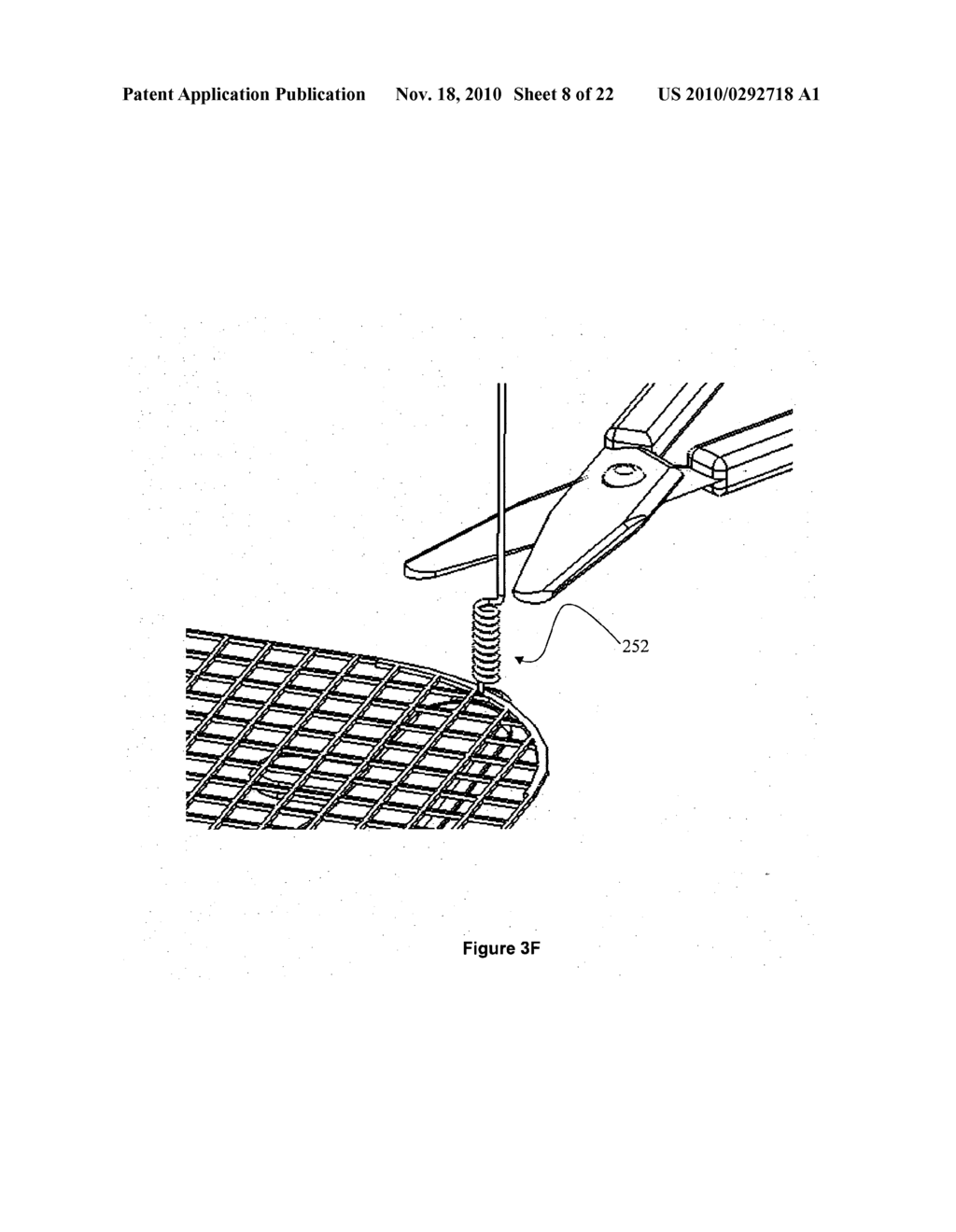 FIXATING MEANS BETWEEN A MESH AND MESH DEPLOYMENT MEANS ESPECIALLY USEFUL FOR HERNIA REPAIR SURGERIES AND METHODS THEREOF - diagram, schematic, and image 09