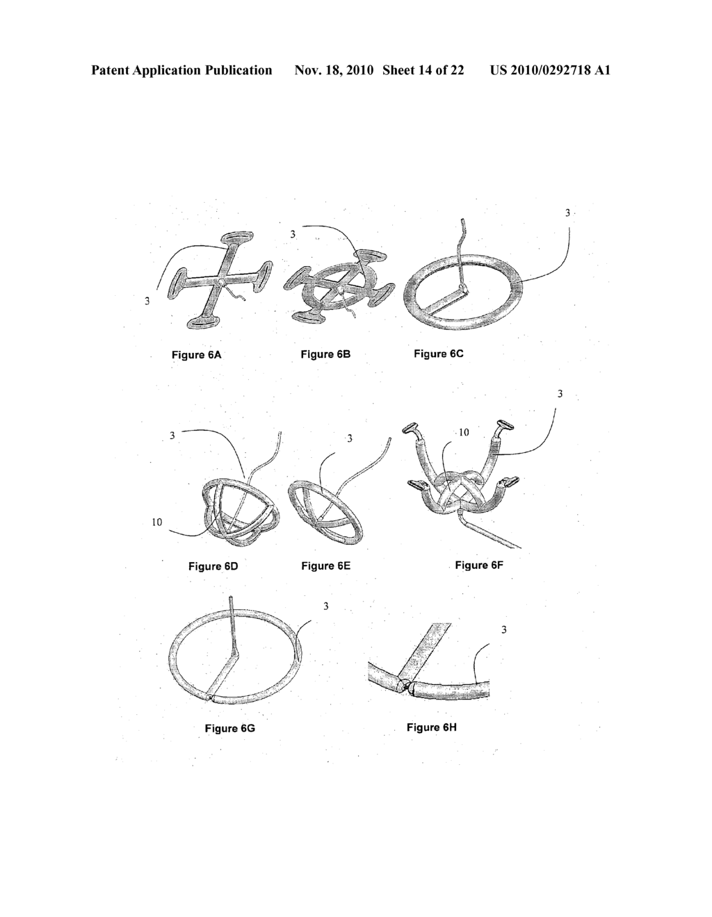 FIXATING MEANS BETWEEN A MESH AND MESH DEPLOYMENT MEANS ESPECIALLY USEFUL FOR HERNIA REPAIR SURGERIES AND METHODS THEREOF - diagram, schematic, and image 15