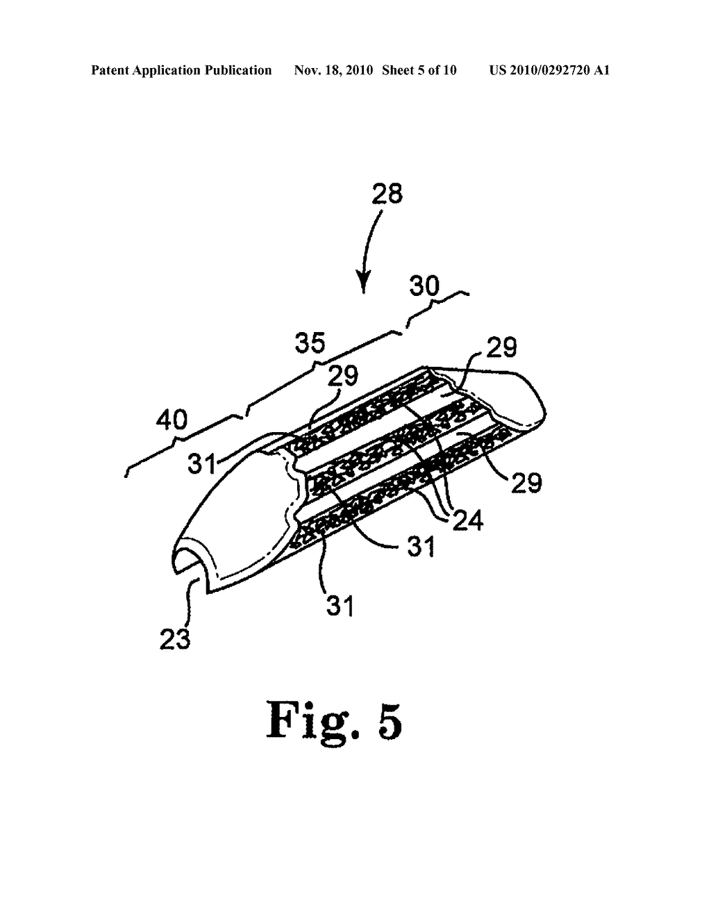 ROTATIONAL ATHERECTOMY DEVICE AND METHOD TO IMPROVE ABRADING EFFICIENCY - diagram, schematic, and image 06