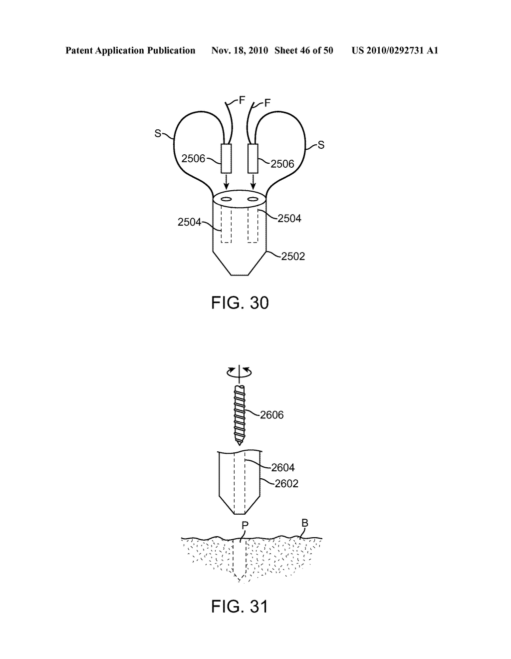 METHODS AND DEVICES TO TREAT DISEASED OR INJURED MUSCULOSKELETAL TISSUE - diagram, schematic, and image 47