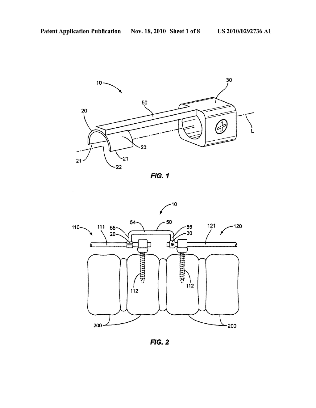 Linkage for Connection of Fusion and Non-Fusion Systems - diagram, schematic, and image 02