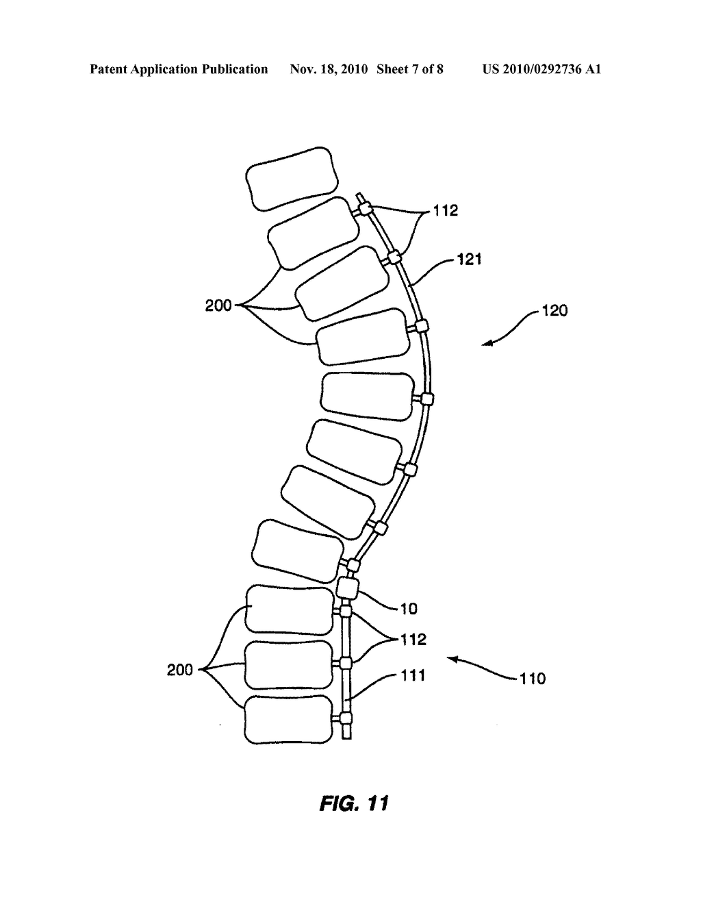 Linkage for Connection of Fusion and Non-Fusion Systems - diagram, schematic, and image 08