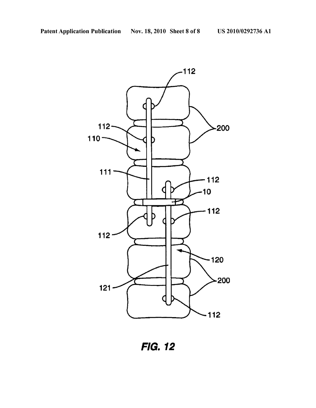 Linkage for Connection of Fusion and Non-Fusion Systems - diagram, schematic, and image 09