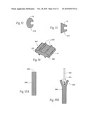 Systems and methods for the fixation or fusion of bone diagram and image