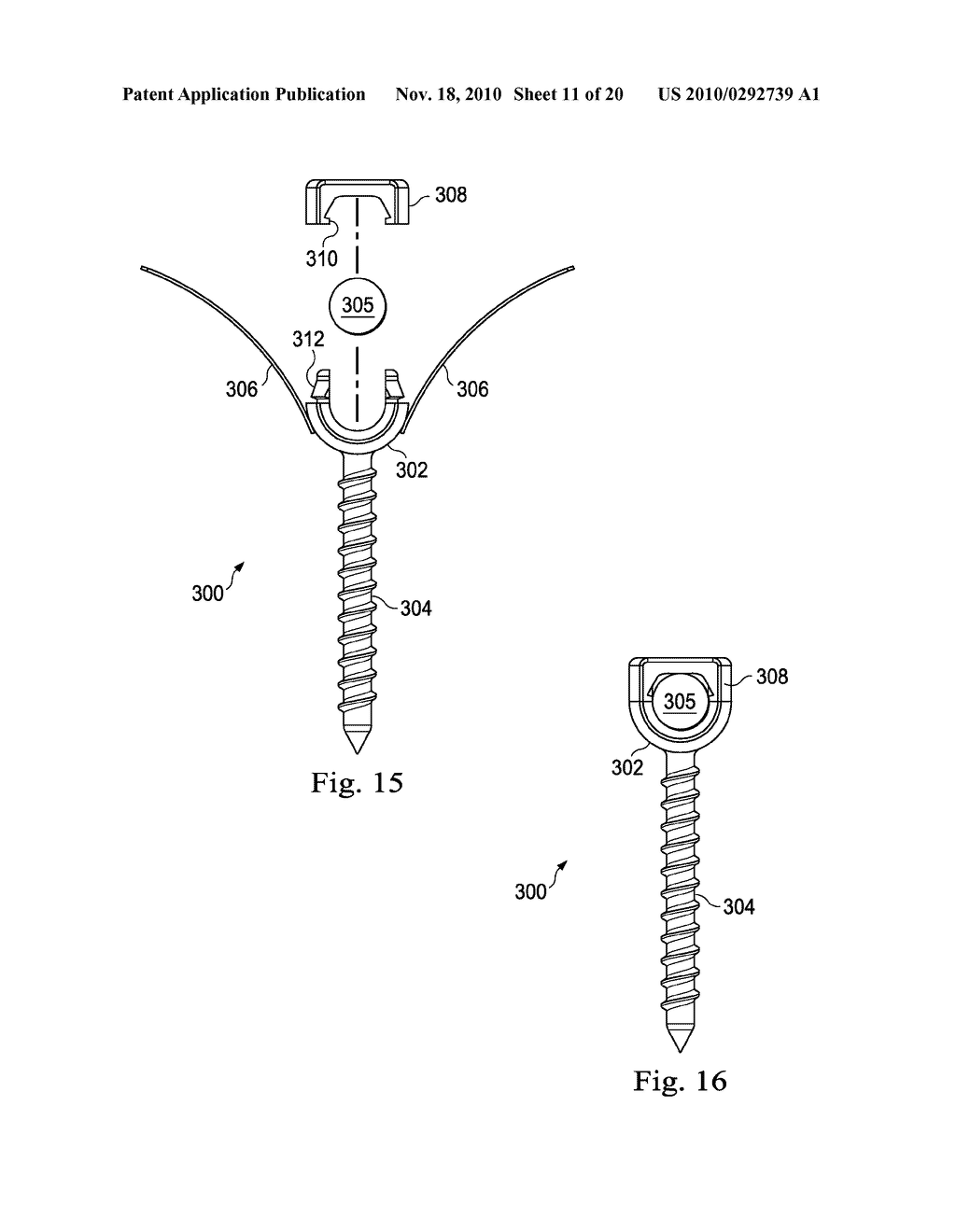 Bone Screws With Improved Locking Mechanisms - diagram, schematic, and image 12