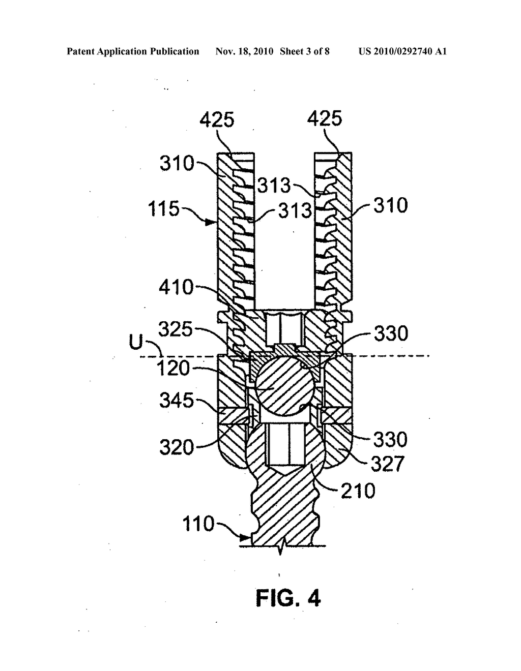 PEDICLE SCREW ASSEMBLY - diagram, schematic, and image 04