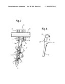 BONE ANCHORING NAIL diagram and image