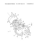 SURGICAL INSTRUMENT diagram and image