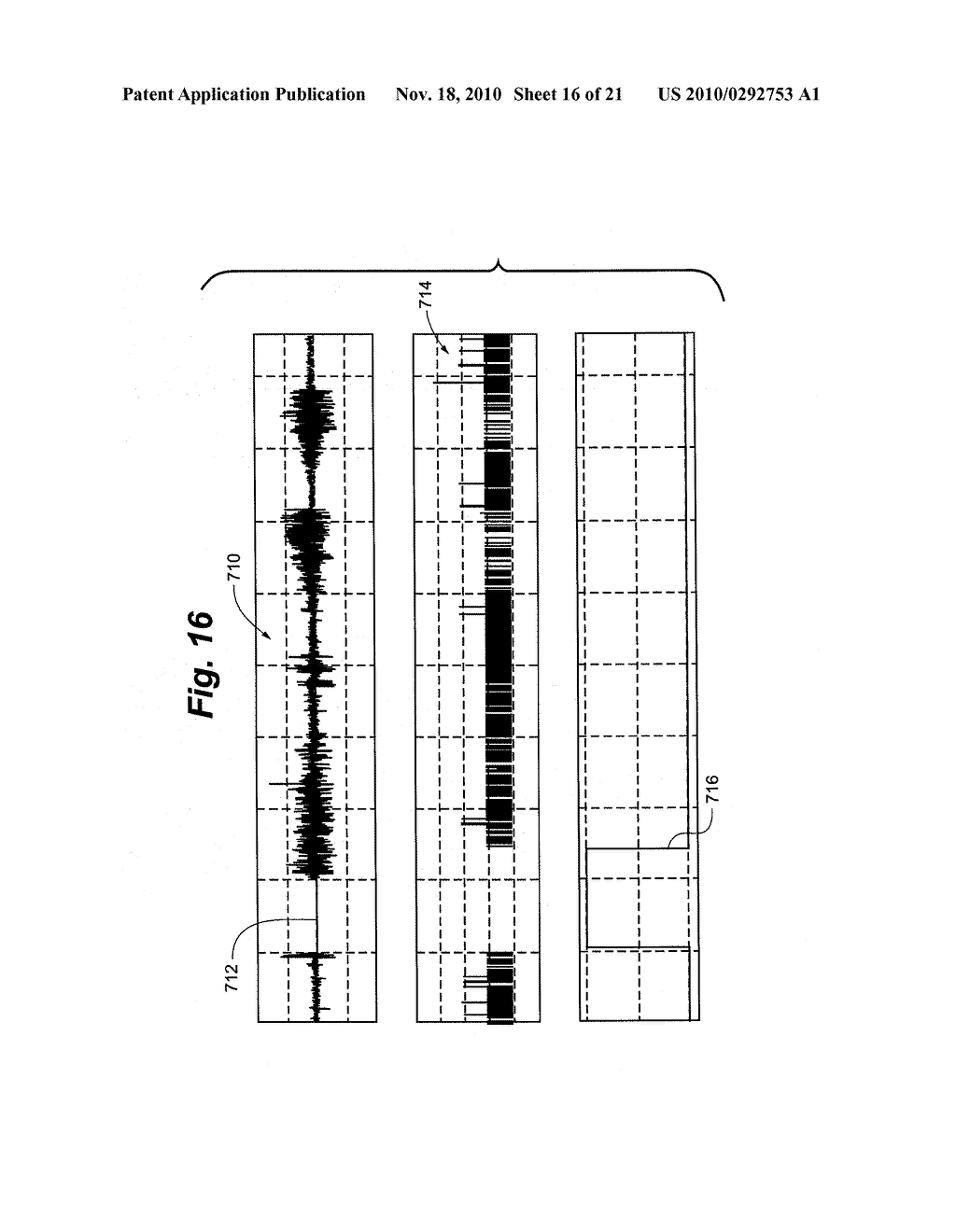 Method and Apparatus for Detection of Nervous System Disorders - diagram, schematic, and image 17