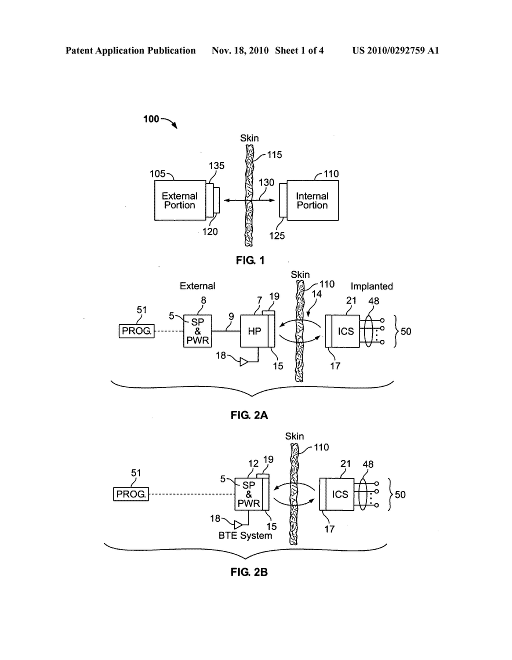 Magnetic field sensor for magnetically-coupled medical implant devices - diagram, schematic, and image 02